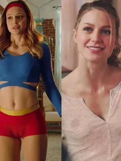 melissa benoist