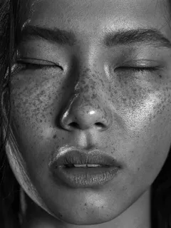 asian with freckles