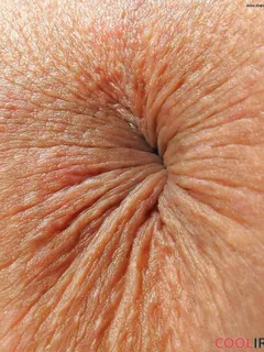 anus close up