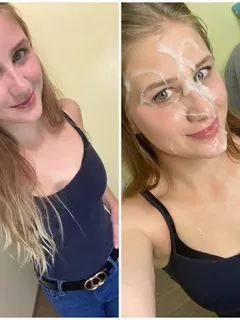 clothed before/after facial