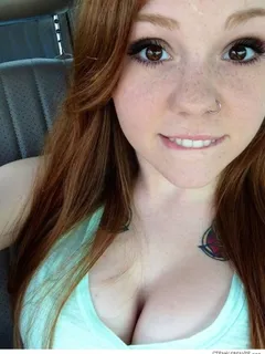 freckles