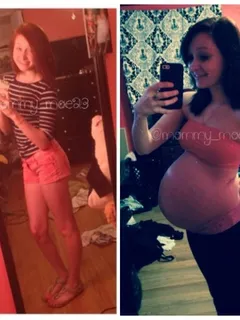 pregnant teen before and after