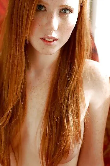 more freckles plz